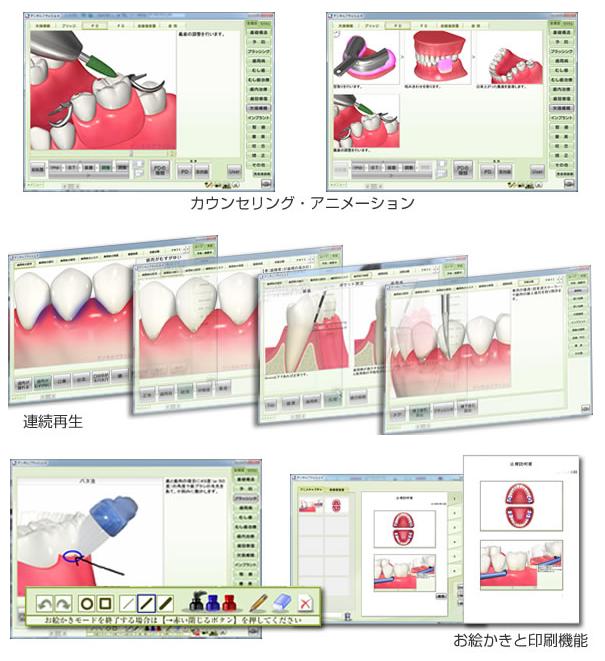 ナルコーム達人+