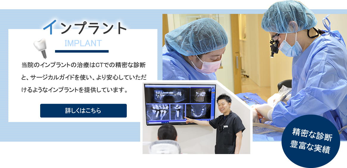 インプラント