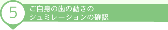 ご自身の歯の動きのシュミレーションの確認