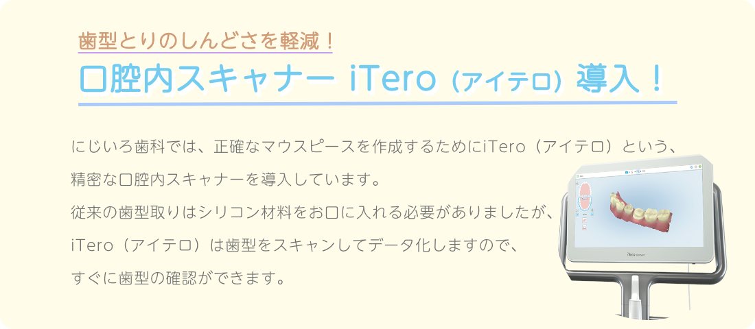 iteroアイテロ