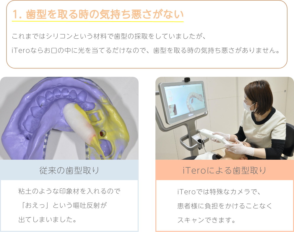 iTeroの特徴