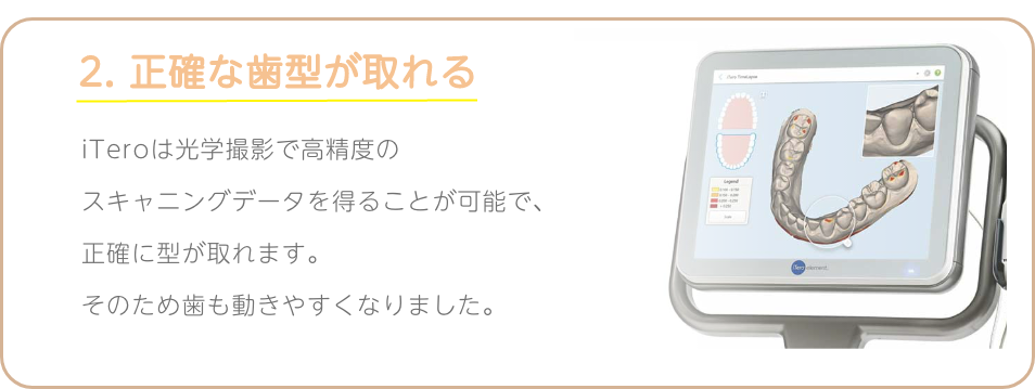 iTeroの特徴