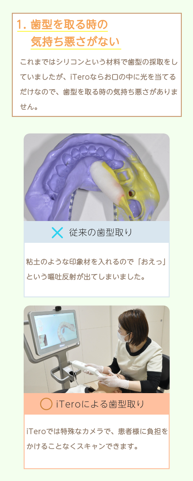 iTeroの特徴