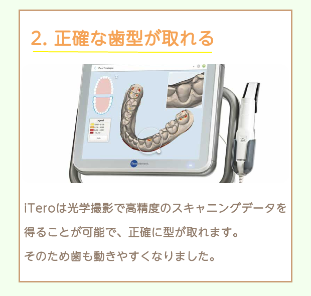 iTeroの特徴